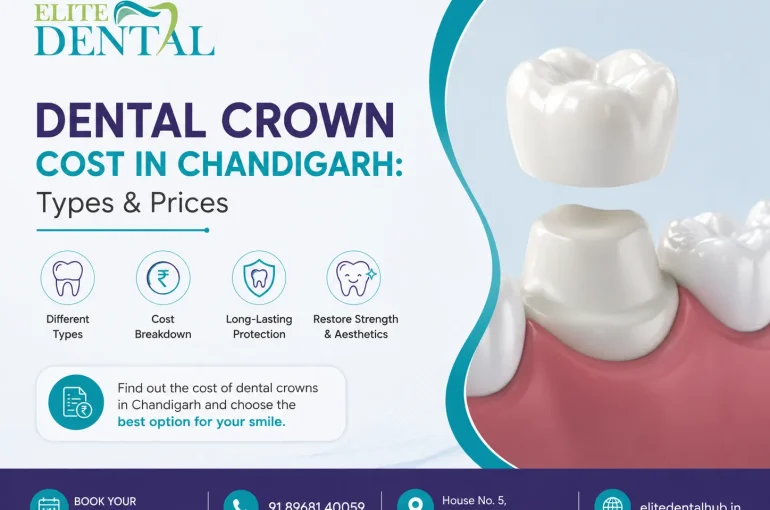 Dental Crown Cost in Chandigarh