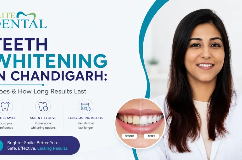 Teeth Whitening in Chandigarh