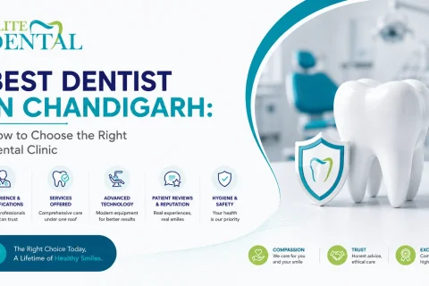 Best Dentist in Chandigarh