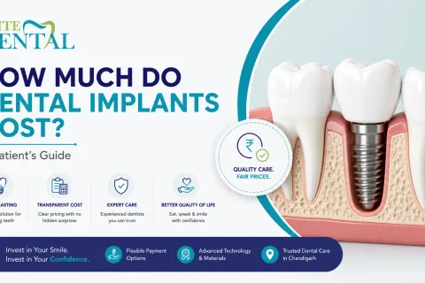 Dental Implants Cost
