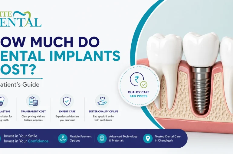 Dental Implants Cost