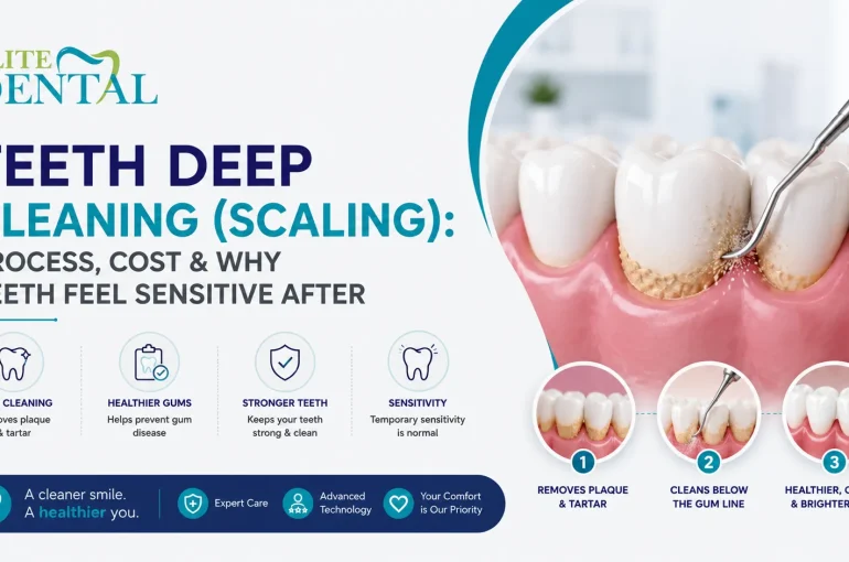 Teeth Deep Cleaning (Scaling): Process, Cost