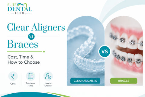 Clear Aligners VS Braces Chandigarh