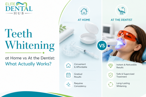 Teeth Whitening Chandigarh