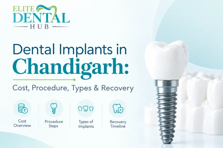 Dental Implants in Chandigarh
