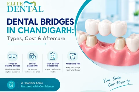 Dental Bridges in Chandigarh