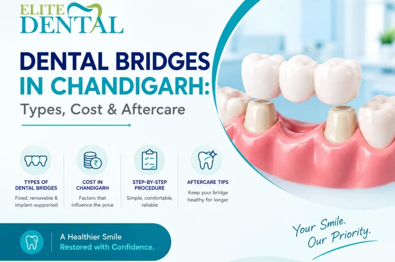 Dental Bridges in Chandigarh