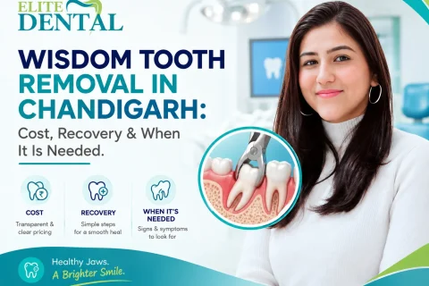 Wisdom tooth extraction in Chandigarh