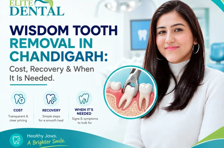 Wisdom tooth extraction in Chandigarh
