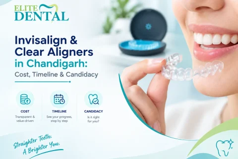Invisalign & Clear Aligners in Chandigarh: