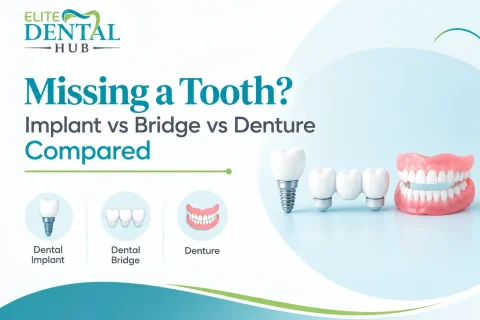 Implant vs Bridge vs Denture | Chandigarh
