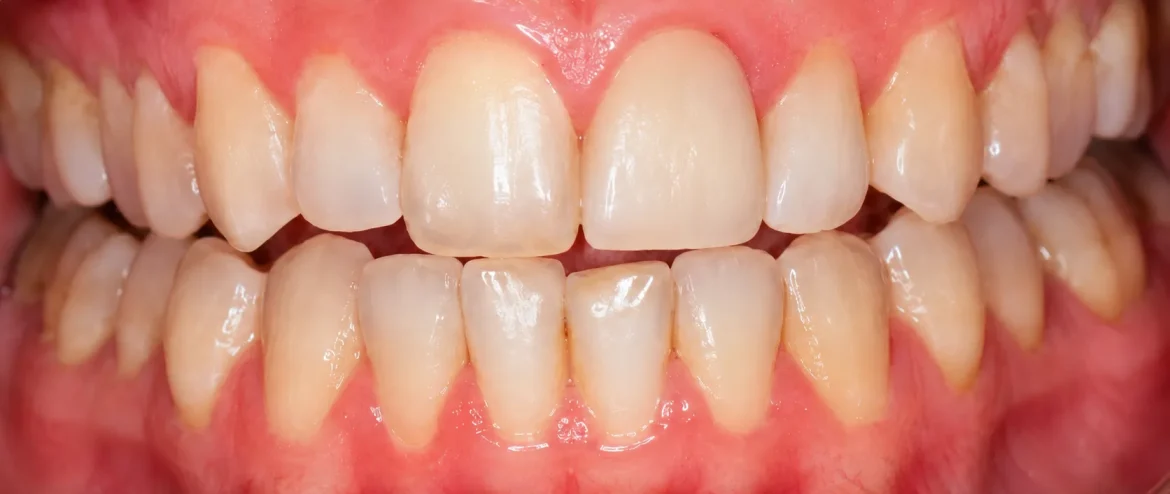 root canal specialist Chandigarh