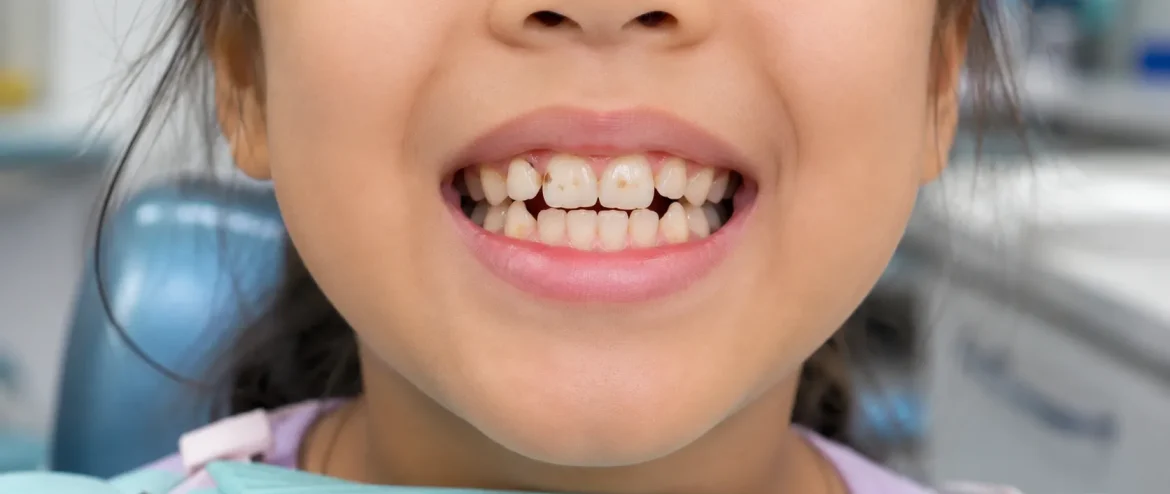Kids dentist Chandigarh
