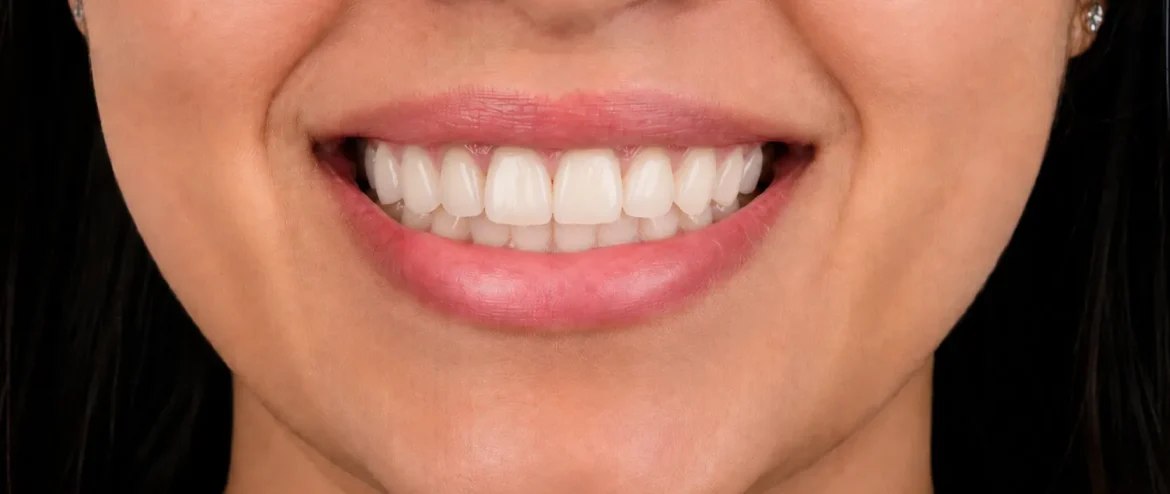 broken tooth repair Chandigarh